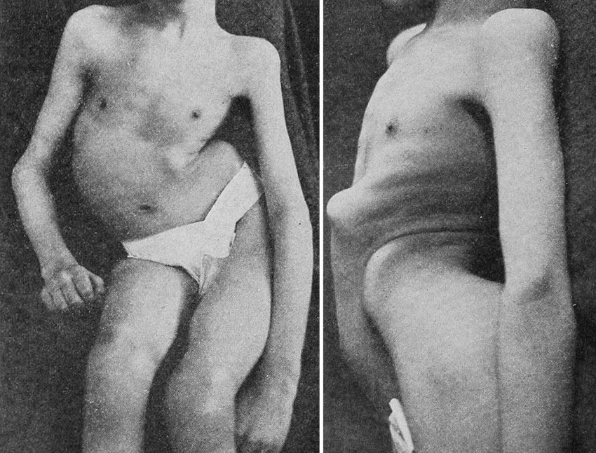 Как СССР помогал вакцинировать японцев