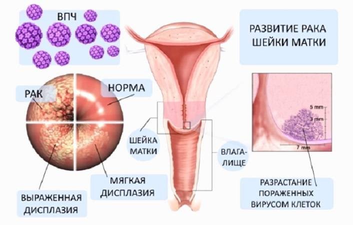 Какие три вида рака врачи смогут победить в ближайшее время