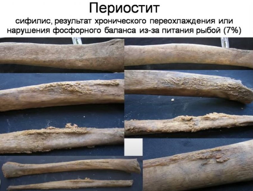 Корабли на мускульной тяге или плавучая каторга