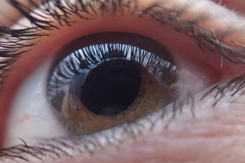 Научиться модифицировать ген глаукомы учёные смогут через 10—20 лет