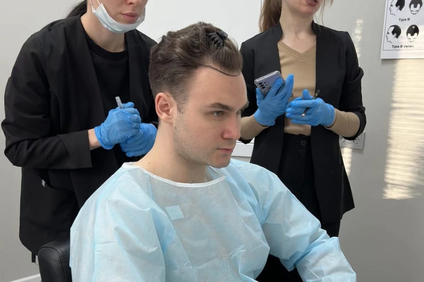 Николай Соболев откровенно рассказал о пересадке волос: «В 31 год я начал стремительно лысеть»