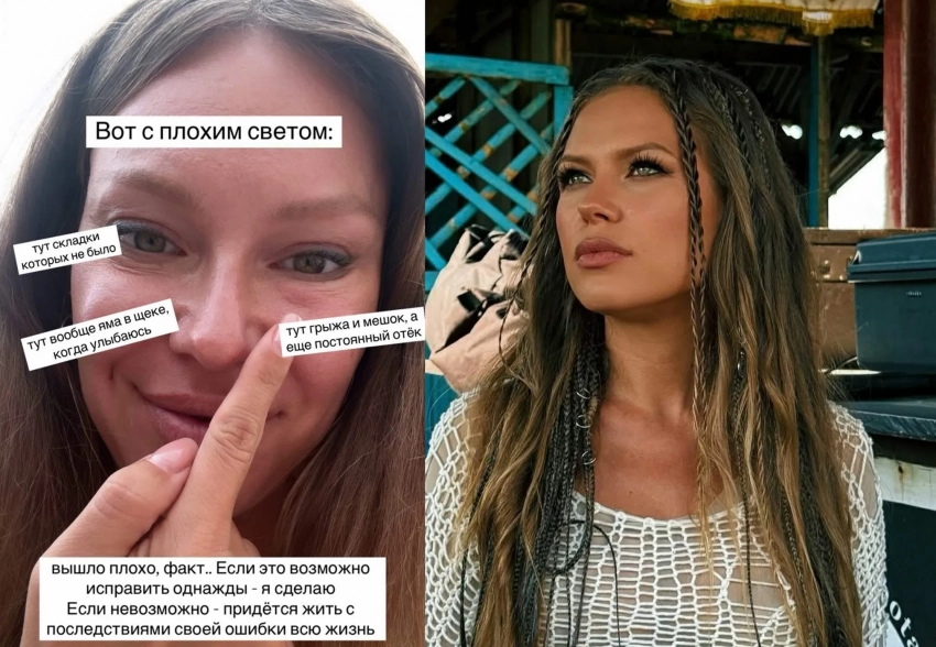 "Хотела стать красивее и моложе. Не вышло". Рита Дакота рассказала о неудачной пластике глаз